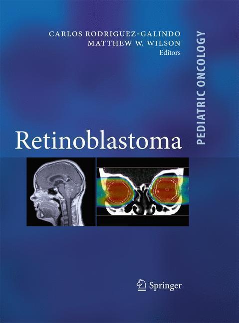 Retinoblastoma 