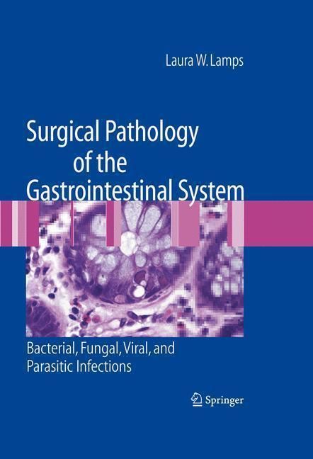 Surgical Pathology of the Gastrointestinal System: Bacterial, Fungal, Viral, and Parasitic Infections 