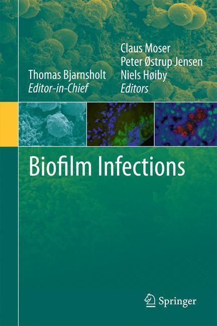 Biofilm Infections 