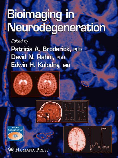 Bioimaging in Neurodegeneration 
