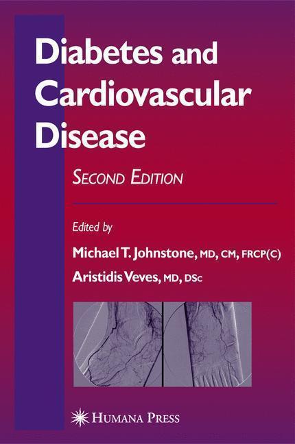 Diabetes and Cardiovascular Disease 