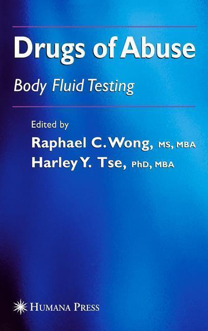 Drugs of Abuse Body Fluid Testing