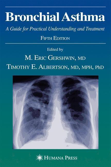 Bronchial Asthma A Guide for Practical Understanding and Treatment