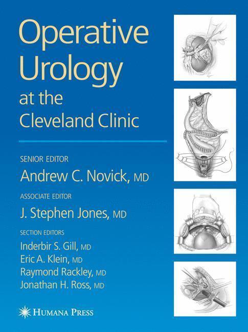 Operative Urology At the Cleveland Clinic