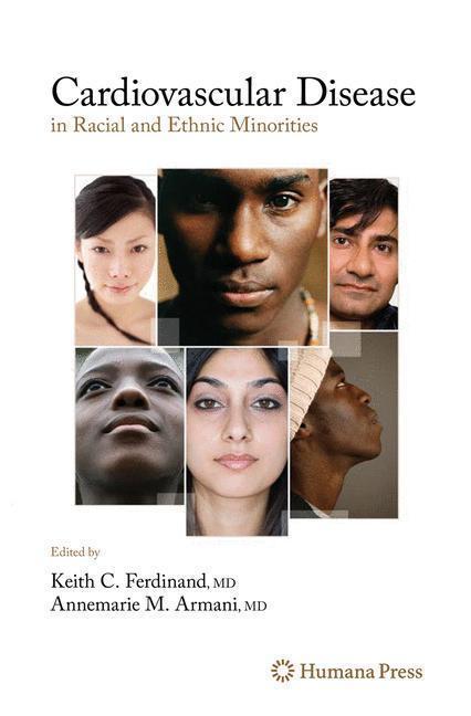 Cardiovascular Disease in Racial and Ethnic Minorities 