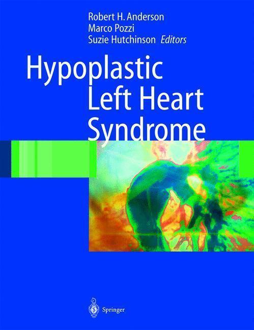 Hypoplastic Left Heart Syndrome 