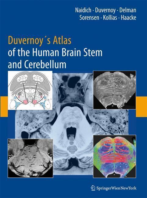 Duvernoy's Atlas of the Human Brain Stem and Cerebellum High-Field MRI, Surface Anatomy, Internal Structure, Vascularization and 3 D Sectional Anatomy