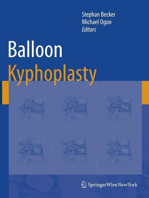Balloon Kyphoplasty 