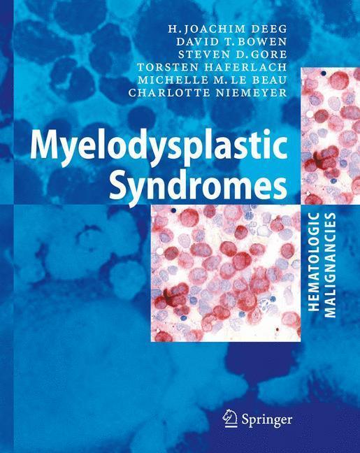 Myelodysplastic Syndromes 