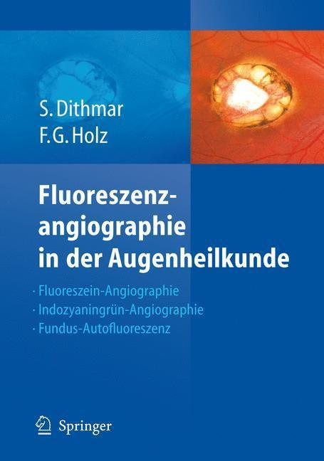 Fluoreszenzangiographie in der Augenheilkunde Fluoreszein-Angiographie, Indozyaningrün-Angiographie und Fundus-Autofluoreszenz