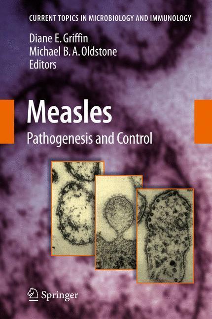 Measles Pathogenesis and Control