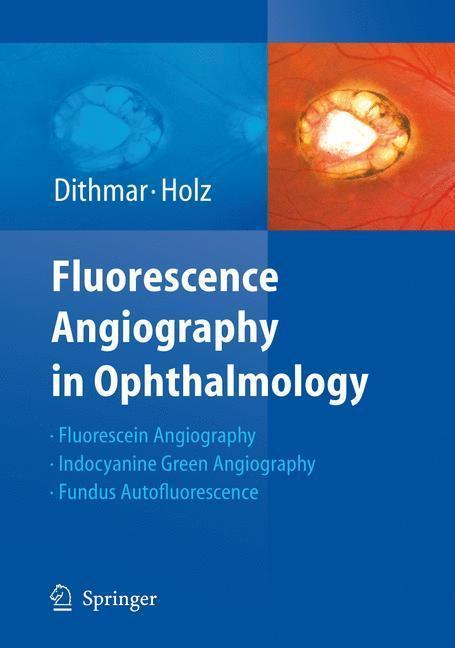 Fluorescence Angiography in Ophthalmology 