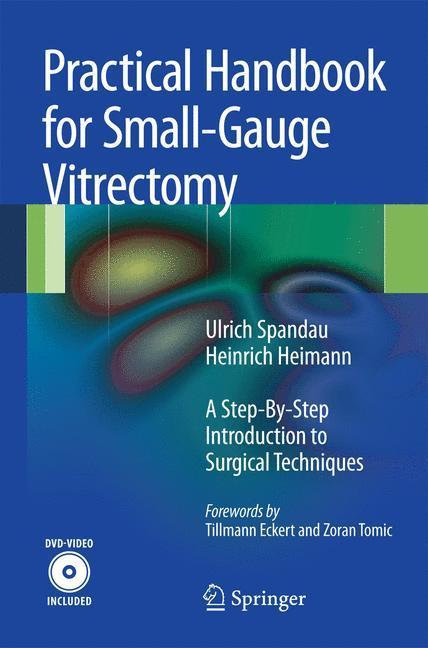Practical Handbook for Small-Gauge Vitrectomy A Step-By-Step Introduction to Surgical Techniques