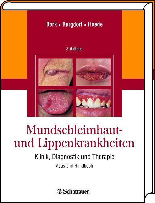 Mundschleimhaut und Lippenkrankheiten Klinik, Diagnostik und Therapie Atlas und Handbuch