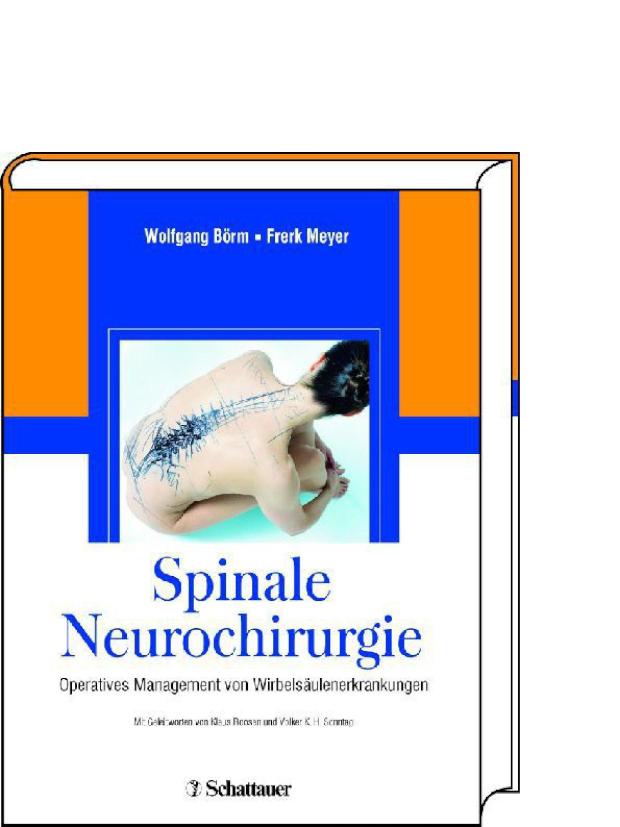 Spinale Neurochirurgie Operatives Management von Wirbelsäulenerkrankungen