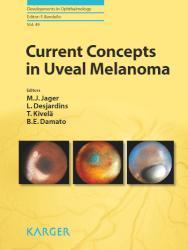 Current Concepts in Uveal Melanoma 