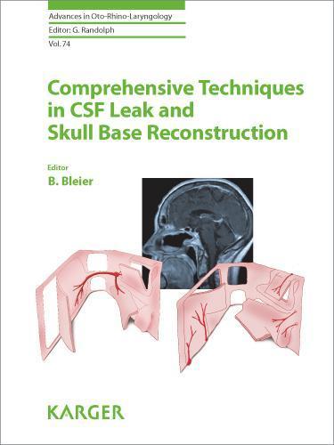 Comprehensive Techniques in CSF Leak Repair and Skull Base Reconstruction 