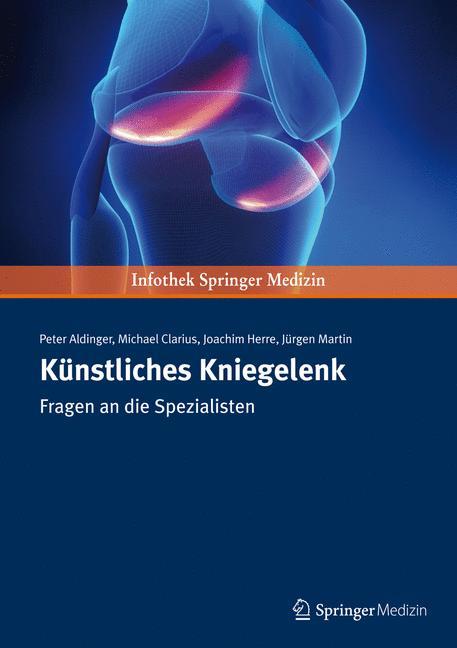 Künstliches Kniegelenk Fragen an die Spezialisten