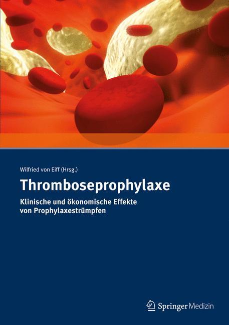 Thromboseprophylaxe Klinische und ökonomische Effekte von Prophylaxestrümpfen 