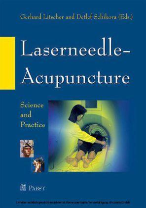 Laserneedle-Acupuncture Science and Practice